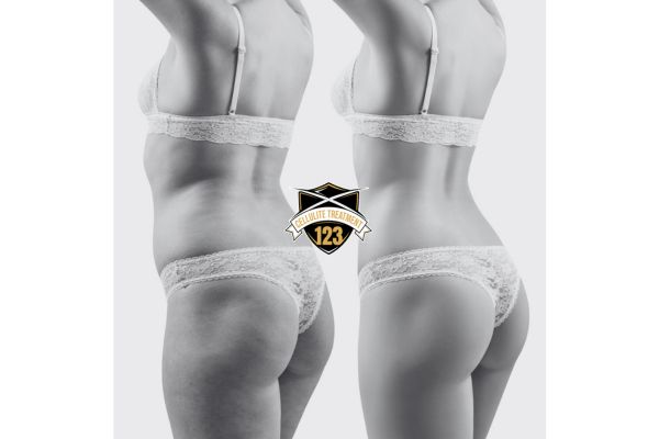 Fat reduction And Toning treatment For Buttocks